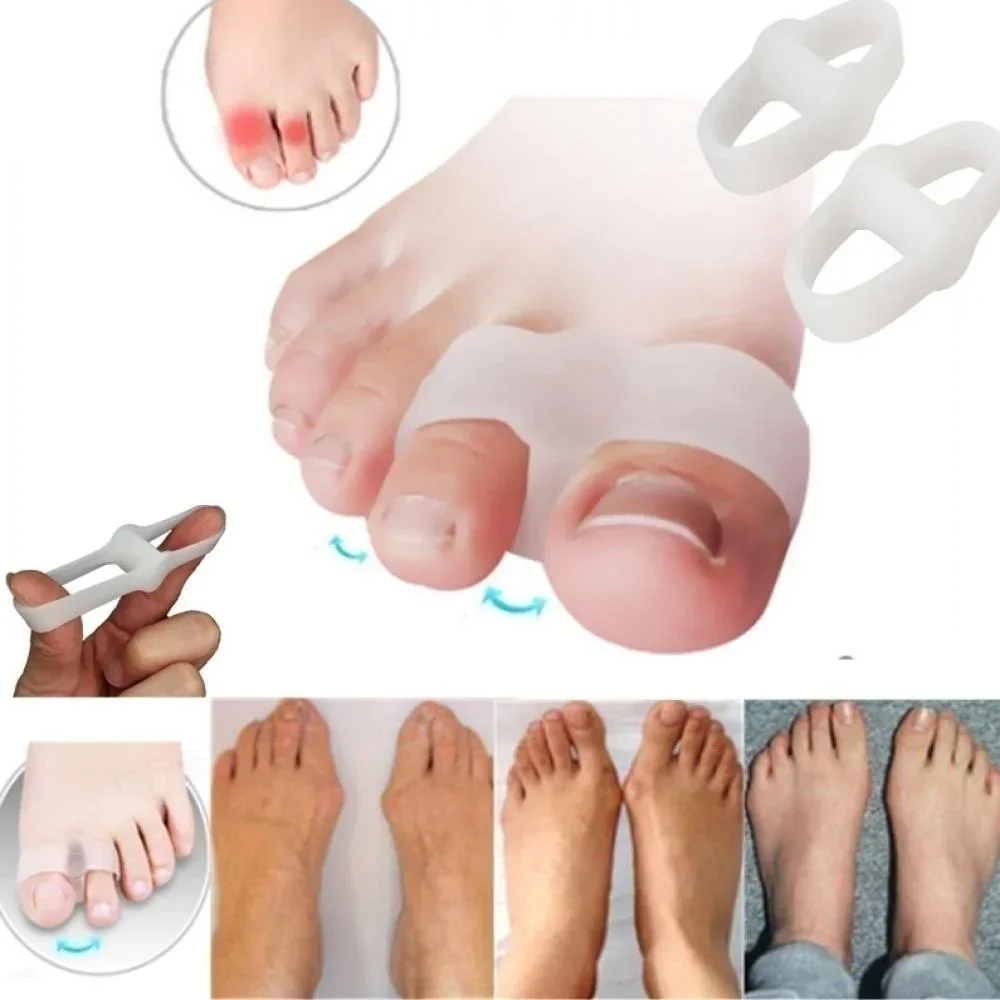 Correction Fluid White - 2개의 구멍 Bunion 교정기 통증 완화